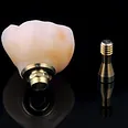 implante dentario df